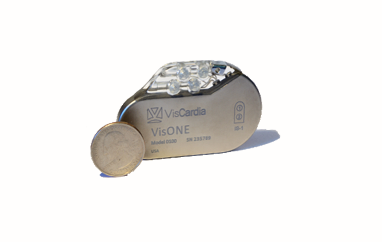 Implantable Pulse Generator
